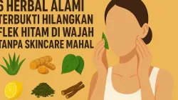 6 Herbal Alami Terbukti Hilangkan Flek Hitam Di Wajah Tanpa Skincare Mahal