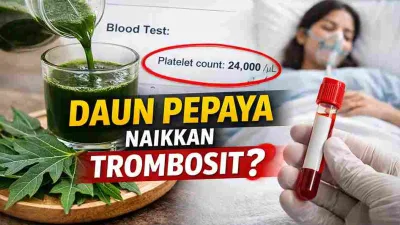 Ilustrasi daun pepaya dan jus daun pepaya dengan hasil tes darah trombosit rendah pada pasien demam berdarah.