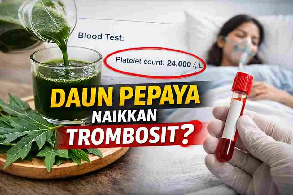 Ilustrasi daun pepaya dan jus daun pepaya dengan hasil tes darah trombosit rendah pada pasien demam berdarah.