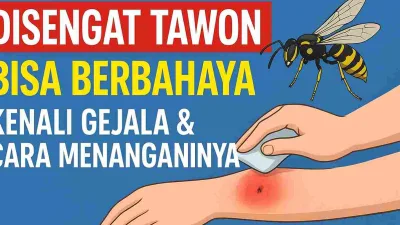 Ilustrasi sengatan tawon di lengan yang menyebabkan bengkak dan nyeri, disertai langkah pertolongan pertama menggunakan kompres dingin.