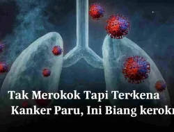Tak Merokok Tapi Terkena Kanker Paru, Ini Biang Keroknya