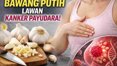 Terungkap! Bawang Putih Bisa Bantu Lawan Kanker Payudara